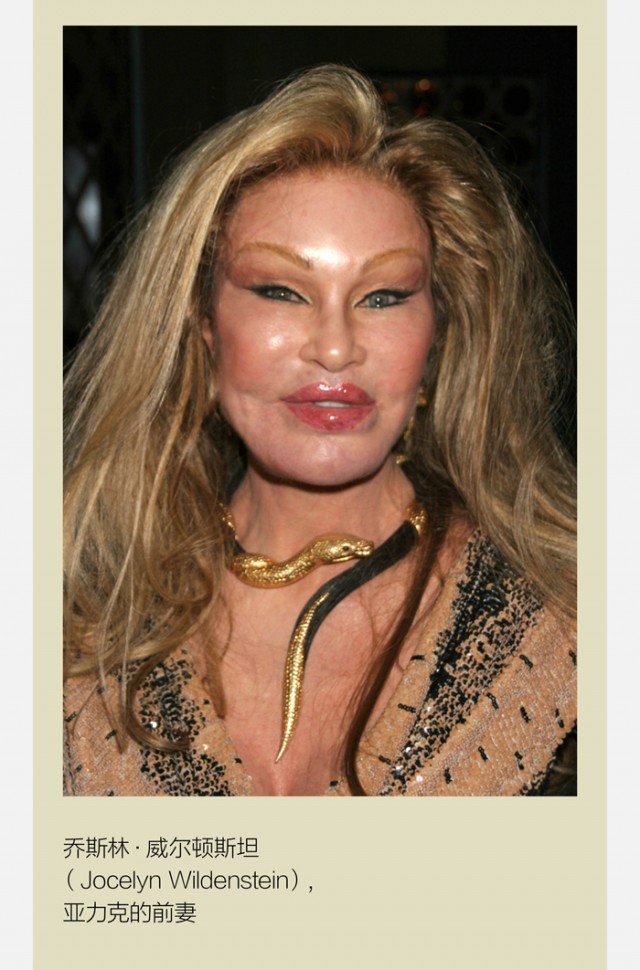 "是的"猫女"乔斯林·威尔顿斯坦(jocelyn wildenstein,活跃于美国